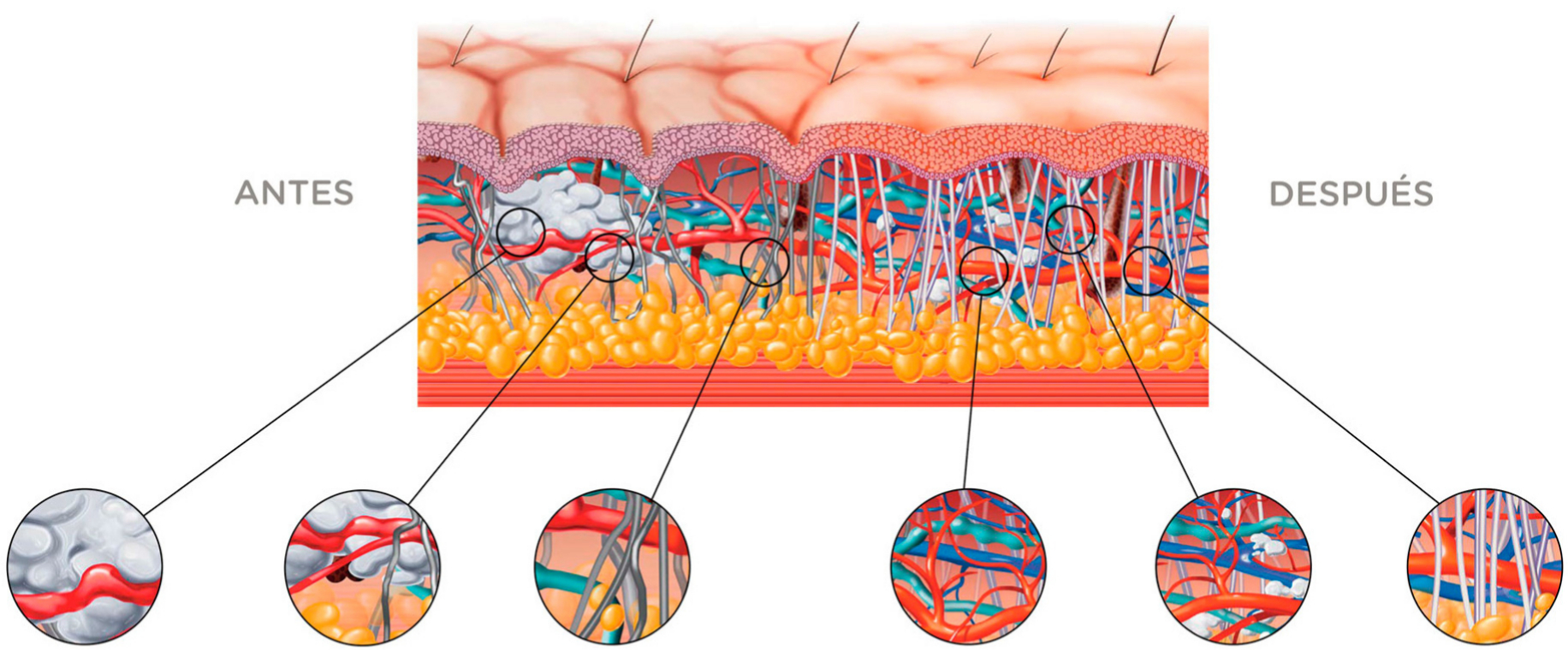 Efectos BTL X-WAVE TM